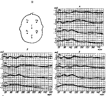  79     ()             (    E  , 1966) II